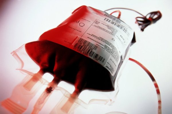 فراورده ای با عمرکم و فواید زیاد